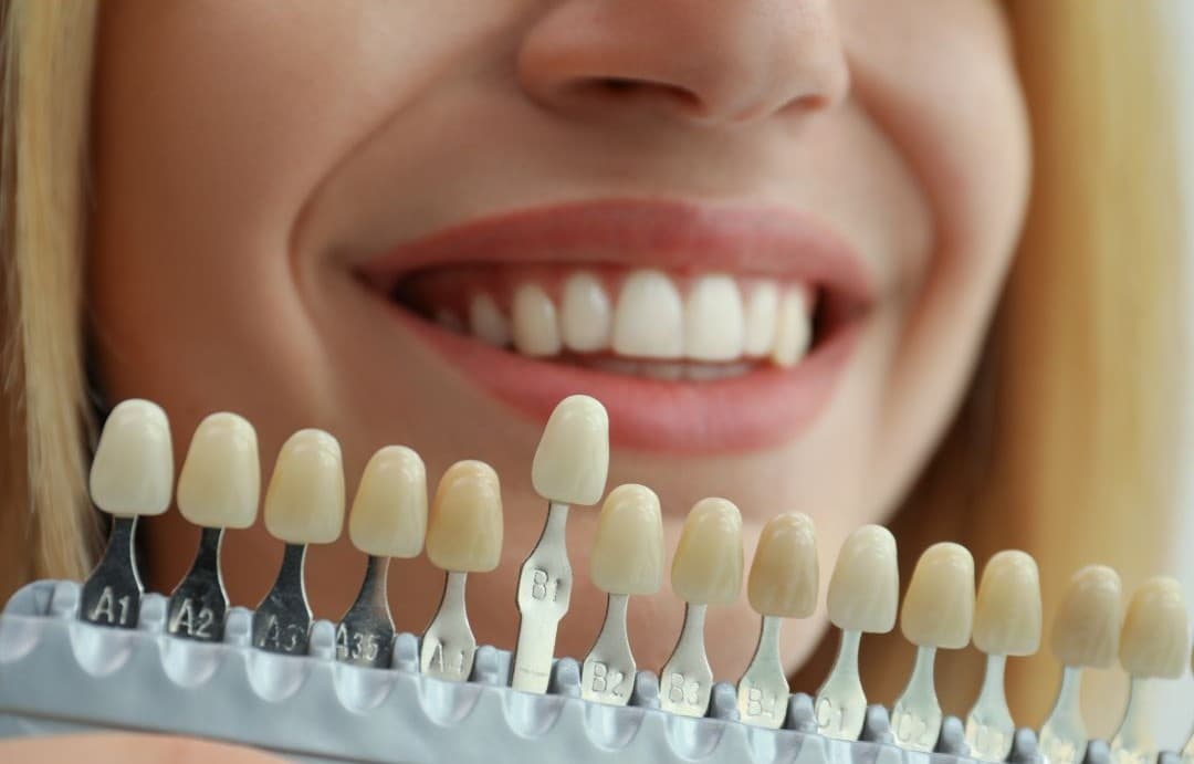 Cosmetic dentistry smile consultation