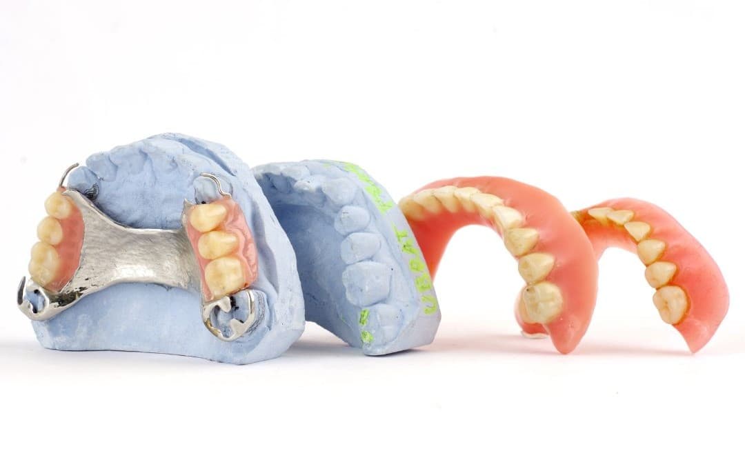 Denture consultation